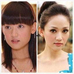 明星隆鼻前后对比照